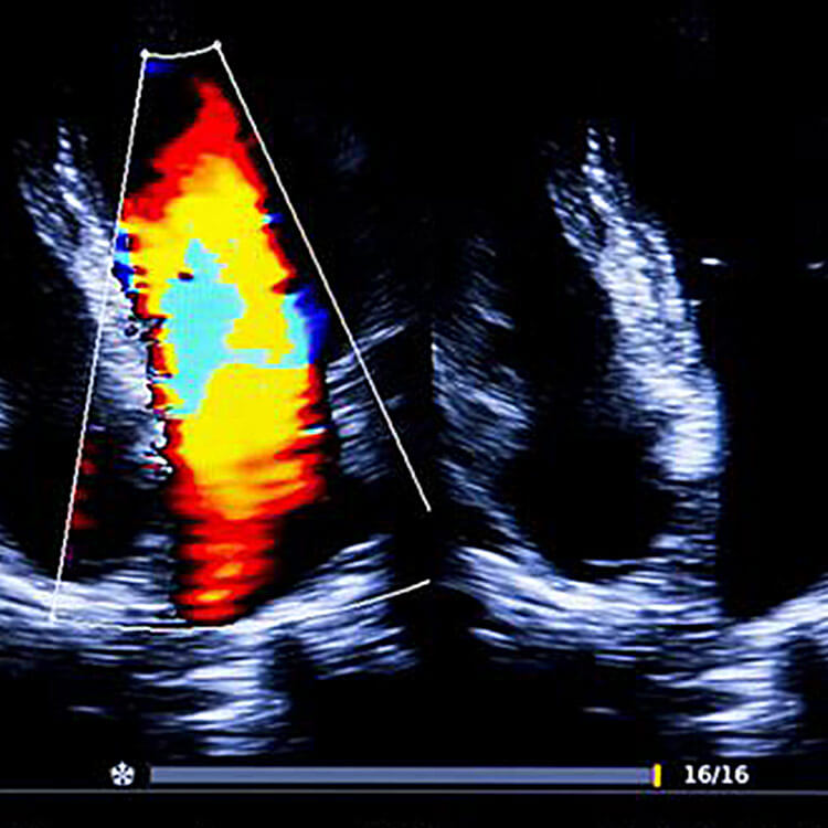 Portable Medical Diagnostics offers Ultrasound (sonogram)