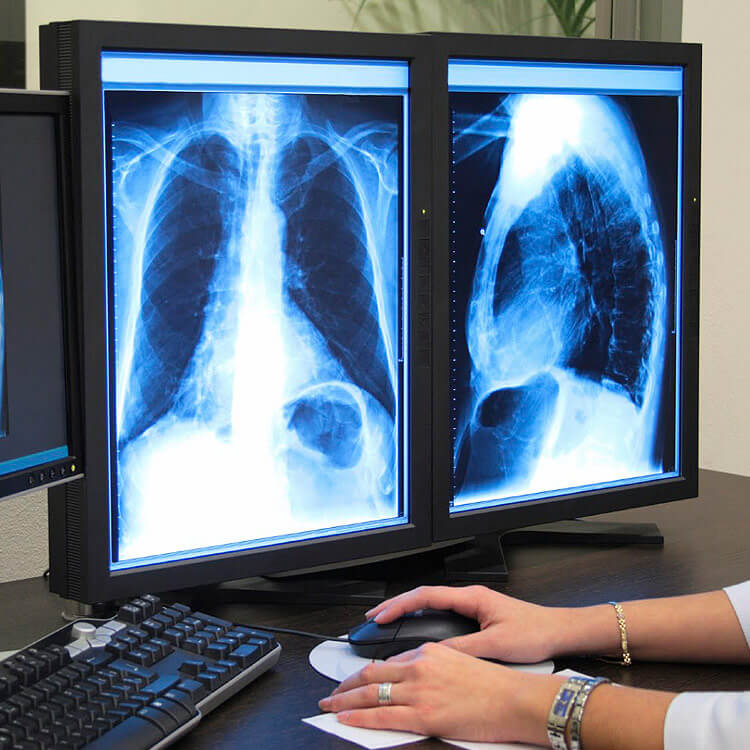 Portable Medical Diagnostics offers digital X-rays